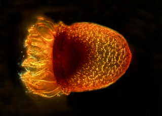 Illustration for article titled Parasites, deadly bugs and fungi are more beautiful than you could possibly imagine